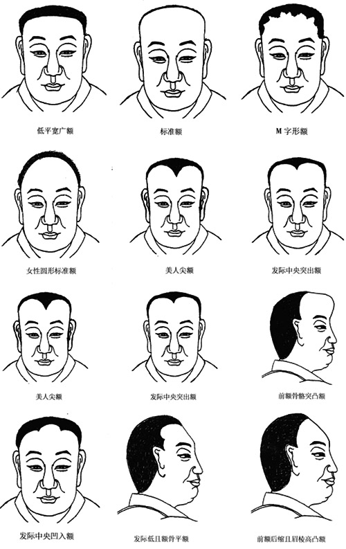 各种额头面相图解