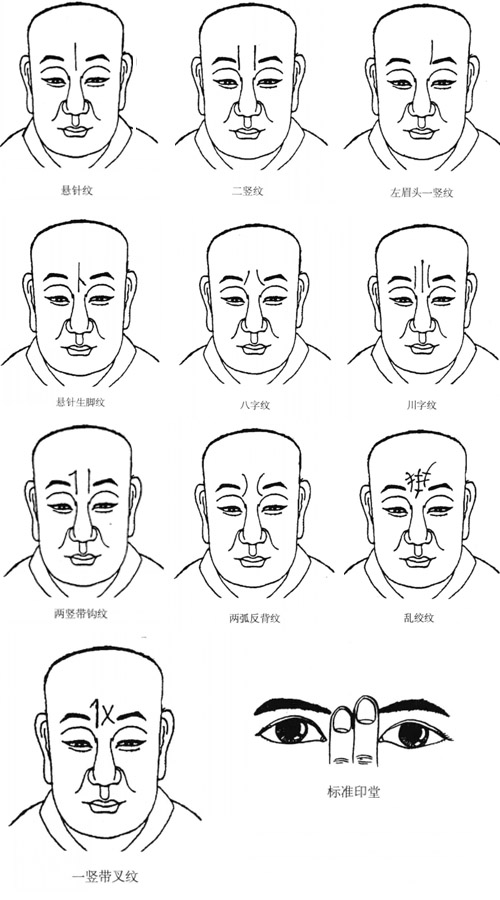 各种印堂纹痕图解及相理分析